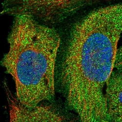 PLEKHO2 Antibody, Novus Biologicals:Antibodies:Primary Antibodies